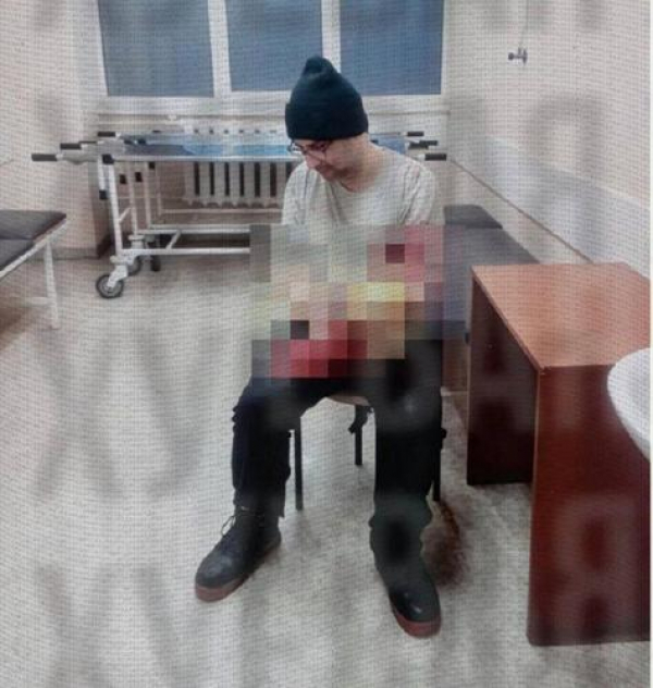 В Одессе молодой человек попытался отпилить себе руку болгаркой чтобы избежать мобилизации